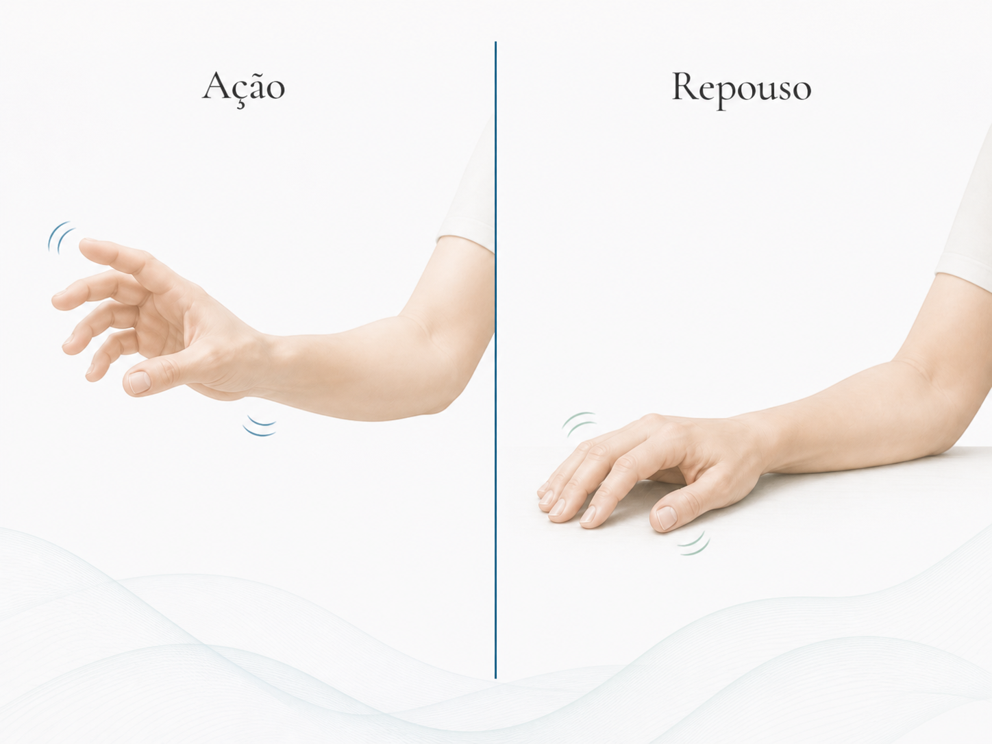 Tremor em ação e repouso - diferentes causas e diferentes tratamentos